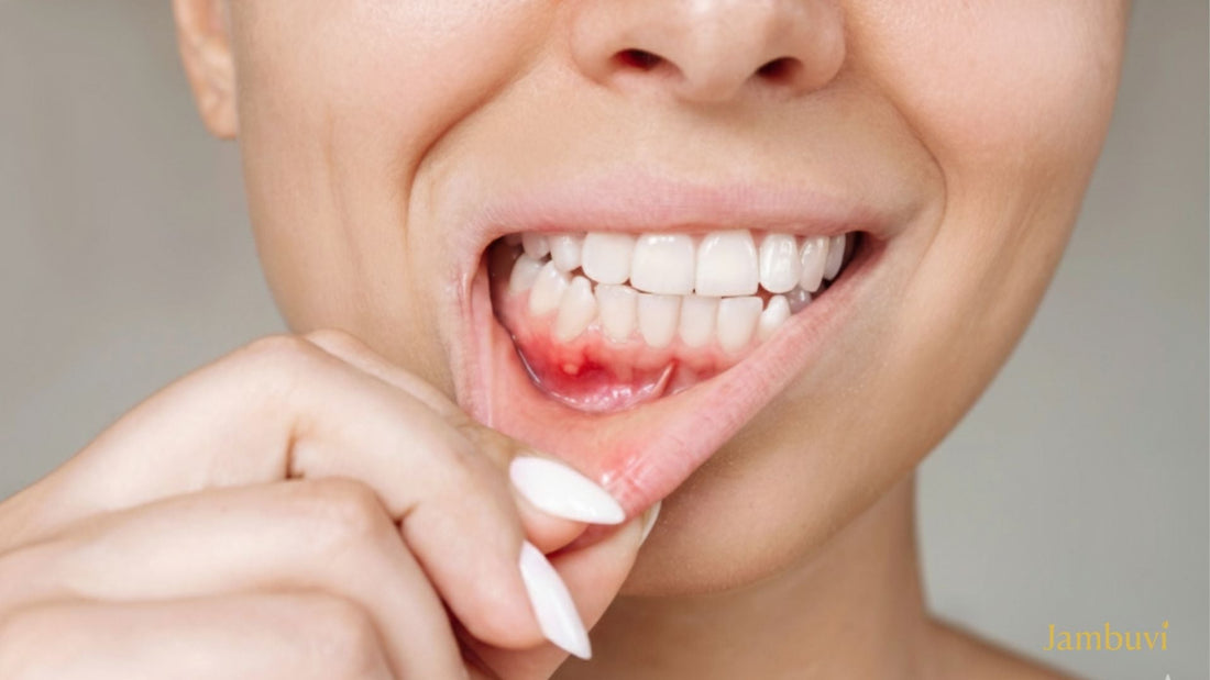 Gum Disease Is Silent Until It’s Expensive — Here’s How to Stop It Early